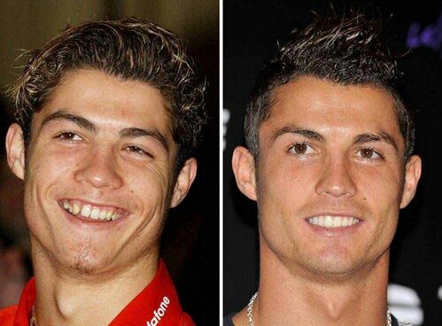 CristianoRonaldoBeforeAfter.jpg